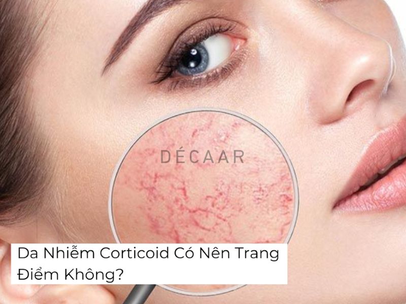 Da nhiễm corticoid có nên trang điểm không